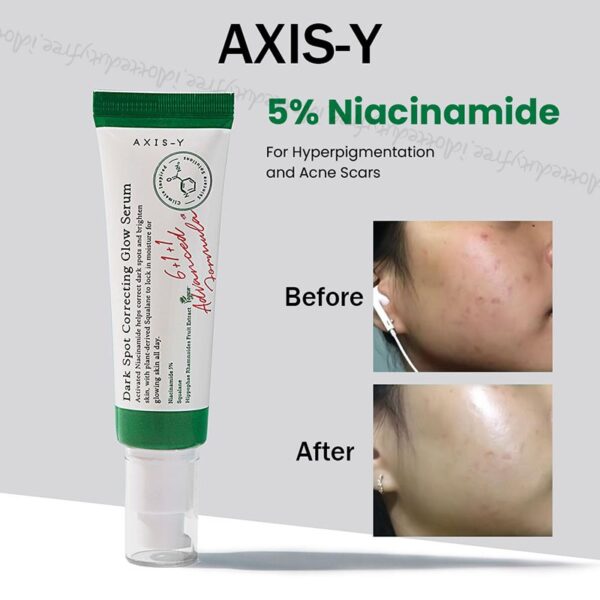 سرم دارک اسپات اکسیس وای