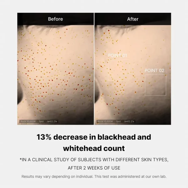 سرم لایه بردار و کنترل منافذ مدی کیوب MEDICUBE Zero Pore One Day Serum - Image 5
