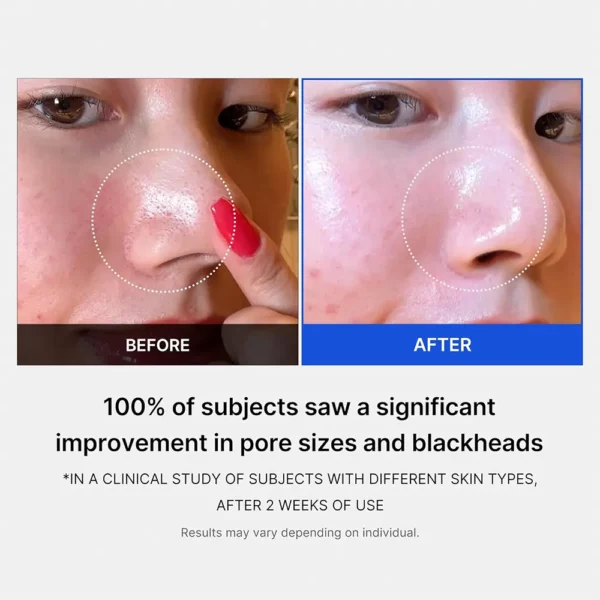 پد لایه بردار و کنترل منافذ مدی کیوب Medicube Zero Pore Pad - Image 4