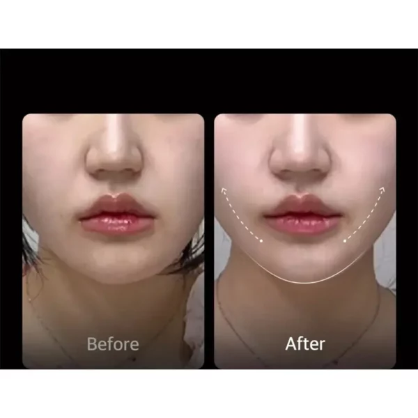 دستگاه جوانساز ایج آر های فوکوس شات مدی کیوب Medicube AGE-R High Focus Shot - Image 7