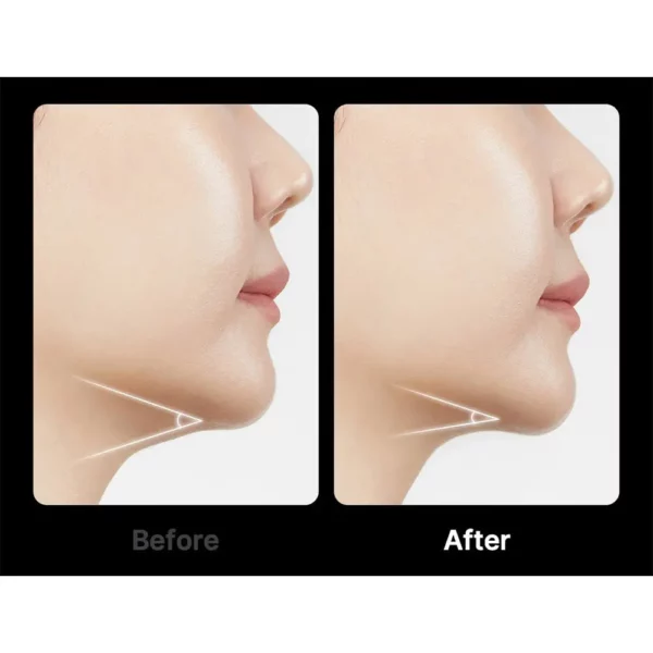 دستگاه جوانساز ایج آر های فوکوس شات مدی کیوب Medicube AGE-R High Focus Shot - Image 6
