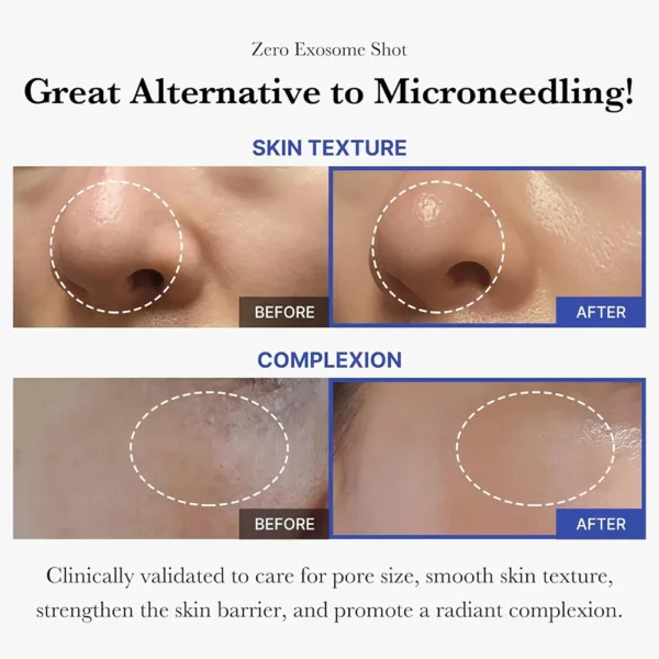آمپول اگزوزم شات 7500 مدی کیوب لایه بردار و کنترل منافذ Medicube One Day Exosome Shot Pore Ampoule - Image 2