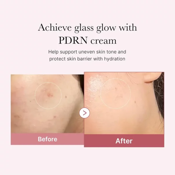 کرم مرطوب کننده هیالورنیک و PDRN مدی کیوب Medicube PDRN Pink Hyaluronic Moisturizing Cream - Image 3